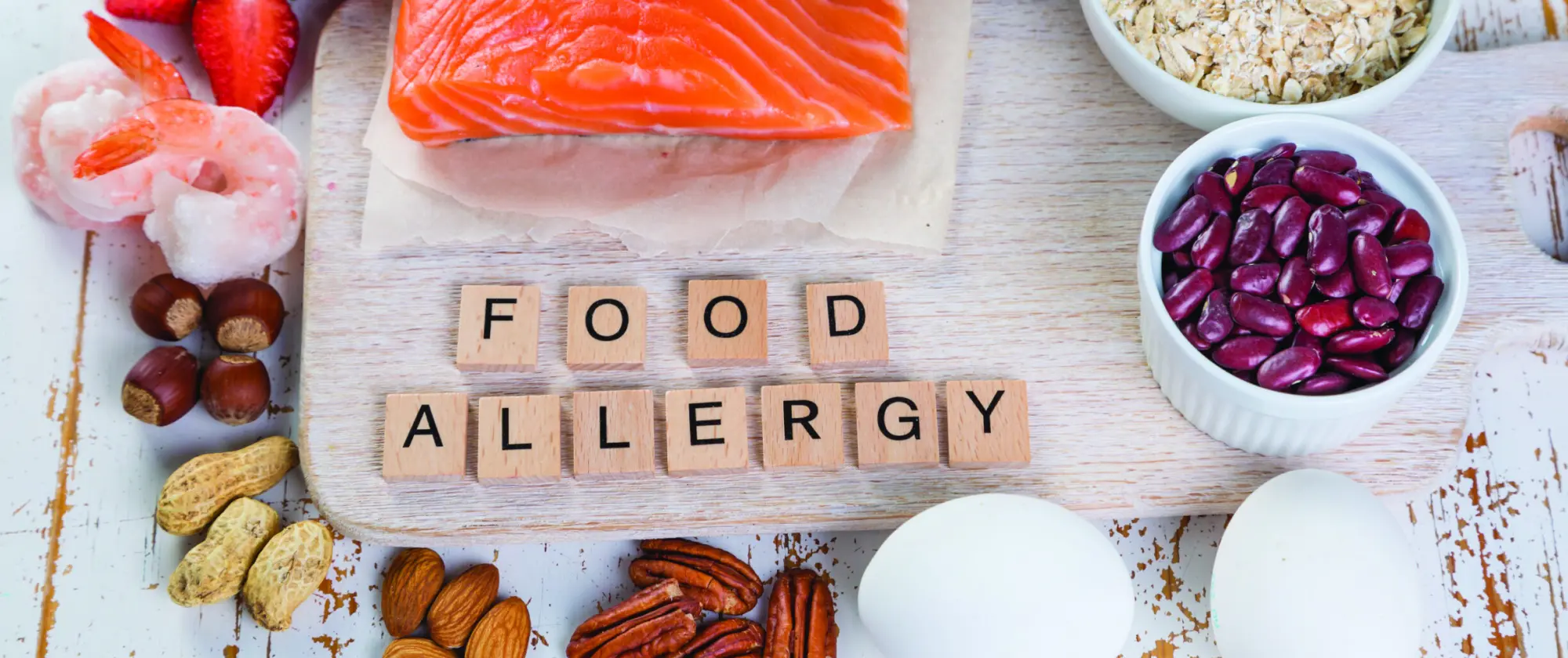 Major Food Allergens